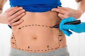 <p>Plastik əməliyyatlardan sonra yaranan təhlükə: "Fat Embolism" (Yağ emboliyası) nədir?</p>